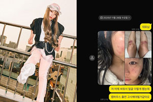 부엌칼까지 데이트 폭력 폭로한 女 래퍼…AOMG 법적 절차→前남친 댓글창 폐쇄
