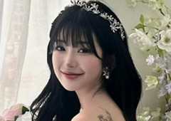 '故최진실 딸' 최준희, '뼈말라' 전 몸 상태 충격…"살 다 찢어져"