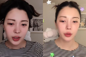 살기 힘들다 리지, 우울증 우려…음주운전 발목→외모 악플까지 '불안'