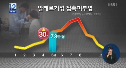 알레르기성 접촉피부염 환자가 5월에 급증한다고 알려졌다. ⓒ KBS 방송화면