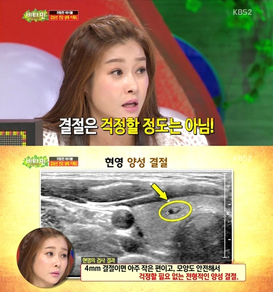 '비타민' 현영의 갑상선 검사 결과가 공개됐다. ⓒ KBS 2TV 방송화면