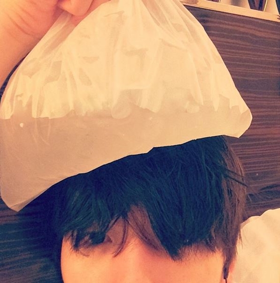 엑소 백현이 얼음 찜질 셀카를 공개했다. ⓒ 백현 인스타그램