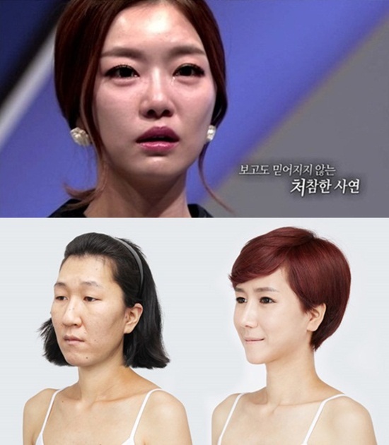 '렛미인4' 20대 할머니 문선영씨의 사연이 소개됐다. ⓒ 스토리온 '렛미인' 방송화면