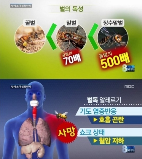 휴가철을 맞아 벌 응급처치에 대한 관심이 급증했다. ⓒ MBC 방송화면