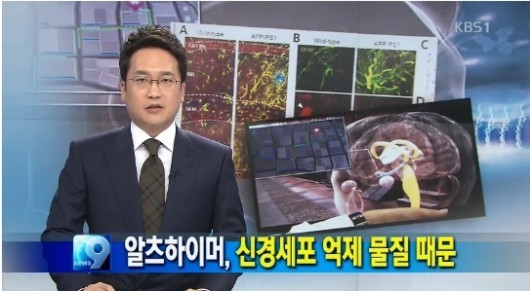 노인성 치매로 알려진 알츠하이머병는 특별한 예방법이 없는 상태다. ⓒ KBS 방송화면