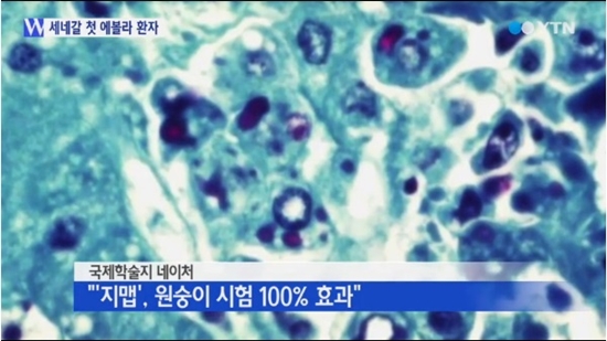 에볼라 치료제 지맵 원숭이 시험 ⓒ YTN