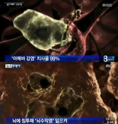 파울러자유아메바란 ⓒ MBC 방송화면