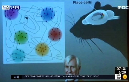 격자세포란 ⓒ MBC 격자세포란