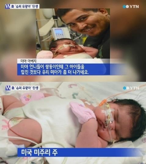 6.4kg 슈퍼 우량아 ⓒ YTN 방송화면