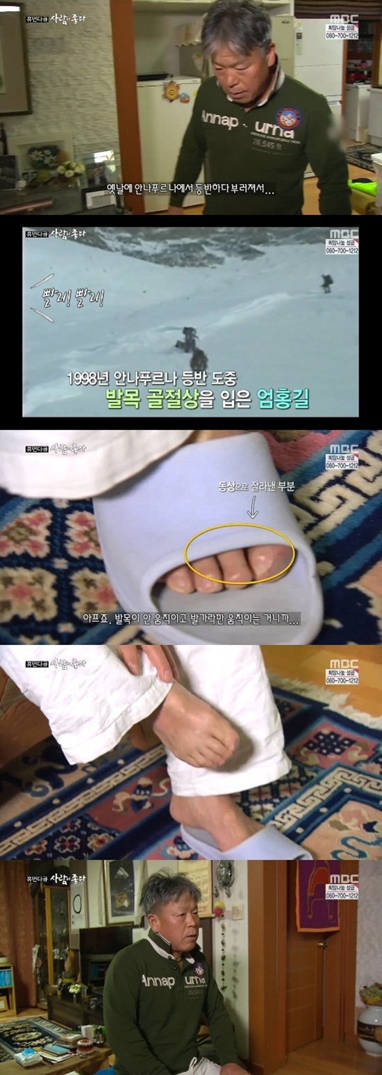 '사람이 좋다'에서 엄홍길의 동상 걸린 발가락이 공개됐다. ⓒ MBC 방송 캡처