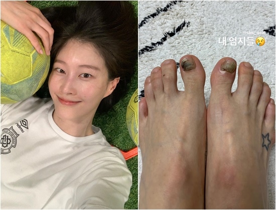 이현이, 걱정스러운 발 상태…눈물의 이현이, 걱정스러운 발 상태…눈물의