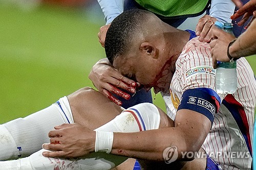 프랑스가 자랑하는 세계적인 축구 선수인 공격수 킬리안 음바페가 유로 2024 경기 도중 코뼈가 부러졌다. 음바페는 18일 독일 뒤셀도르프에서 열린 유로 2024 D조 1차전 오스트리아와의 경기 후반 막판 상대 수비수 케빈 단소와 공중볼을 따내기 위해 경합하다가 충돌했는데 음바페의 코가 단소의 어깨와 부딪혔고, 이후 음바페가 피를 흘리면서 쓰러졌다. 프랑스 대표팀 디디에 데샹은 음바페의 코뼈가 부러진 것 같다고 밝혔다. 연합뉴스