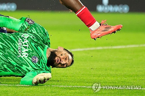 경기 도중 상대의 축구화 스터드에 얼굴이 찍혀 큰 상처를 입었던 잔루이지 돈나룸마가 밝은 얼굴로 근황을 전했다. 돈나룸마는 상처 부위에 치료를 받은 뒤 반려견을 안고 집에서 휴식을 취하는 모습이었다. 큰 부상으로 이어질 수 있었던 대형 사고였고, 돈나룸마의 상태 역시 좋지는 않았지만 다행히 돈나룸마는 충격에서 어느 정도 회복한 듯하다. 사진 연합뉴스