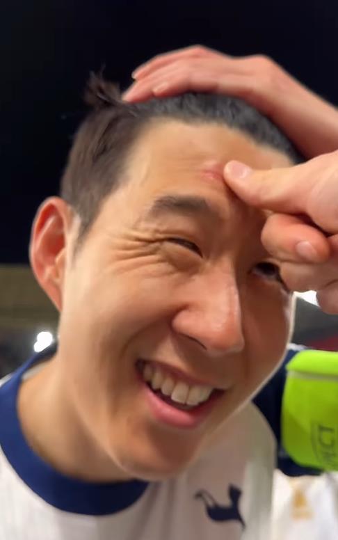 토트넘은 22일 스페인 빌바오의 산 마메스 경기장에서 열린 2024-2025 유럽축구연맹(UEFA) 유로파리그 결승전에서 맨체스터 유나이티드에 1-0 승리를 거두고 대망의 우승 트로피를 차지했다. 주장 손흥민은 지난 2015년 토트넘 입단 뒤 들어올리지 못한 우승컵을 주장으로 가장 먼저 '번쩍' 들어올리는 주인공이 됐다. 손흥민은 15kg 짜리 우승컵 치켜드는 과정에서 누군가 밀어 이마에 상처가 났으나 '행복하다'며 개의치 않았다. 토트넘 홋스퍼