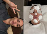 Kim Kardashian Shares Candid Photos of Her Korean Beauty Treatments with 350 Million Followers