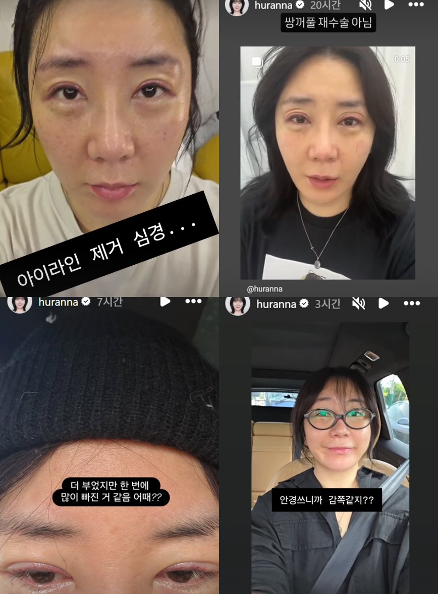 사진=허안나 SNS