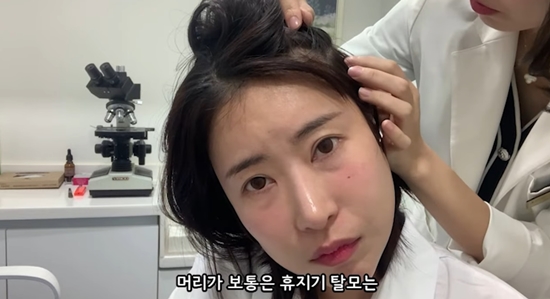 탈모를 걱정하는 이세영. 사진=유튜브 채널 '영평티비'