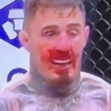 '충격' UFC 챔피언 앞이 보이지 않아→반칙에 '실명+선수 생명' 위기…최악의 상황, 무릎 가격보다 더 무서워