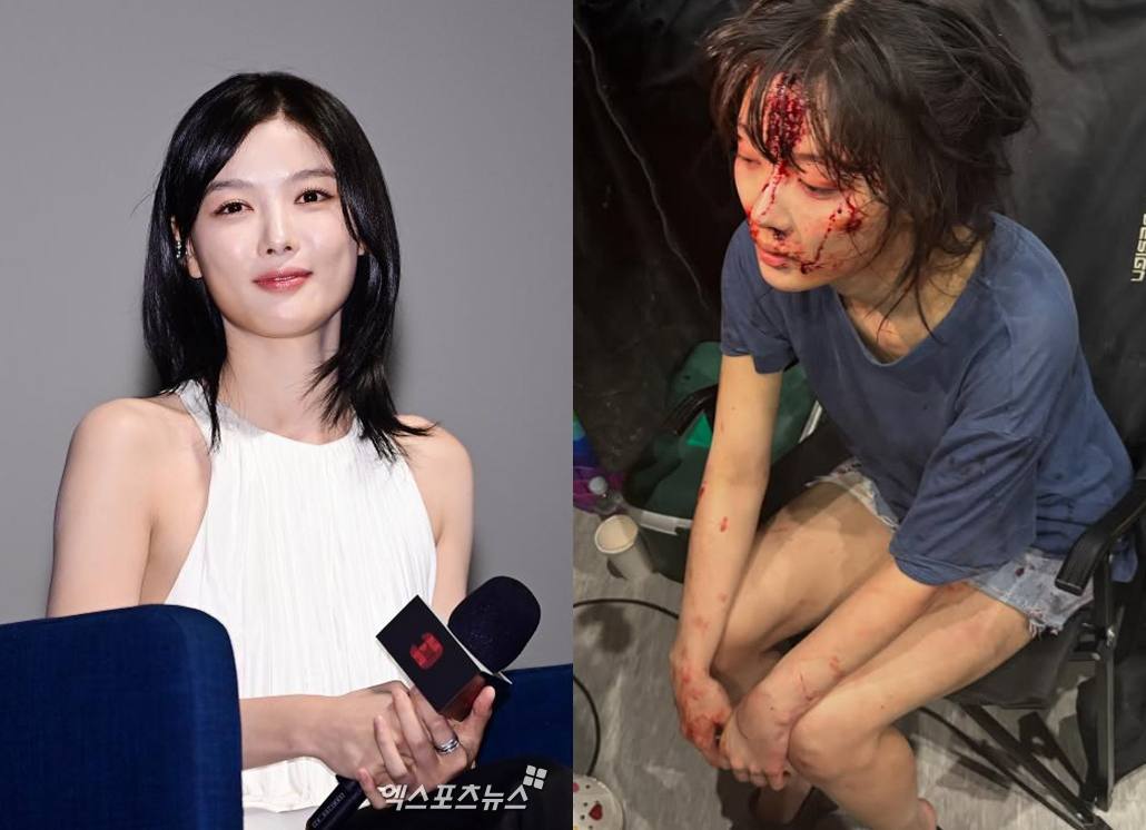 엑스포츠뉴스DB, 김유정 계정