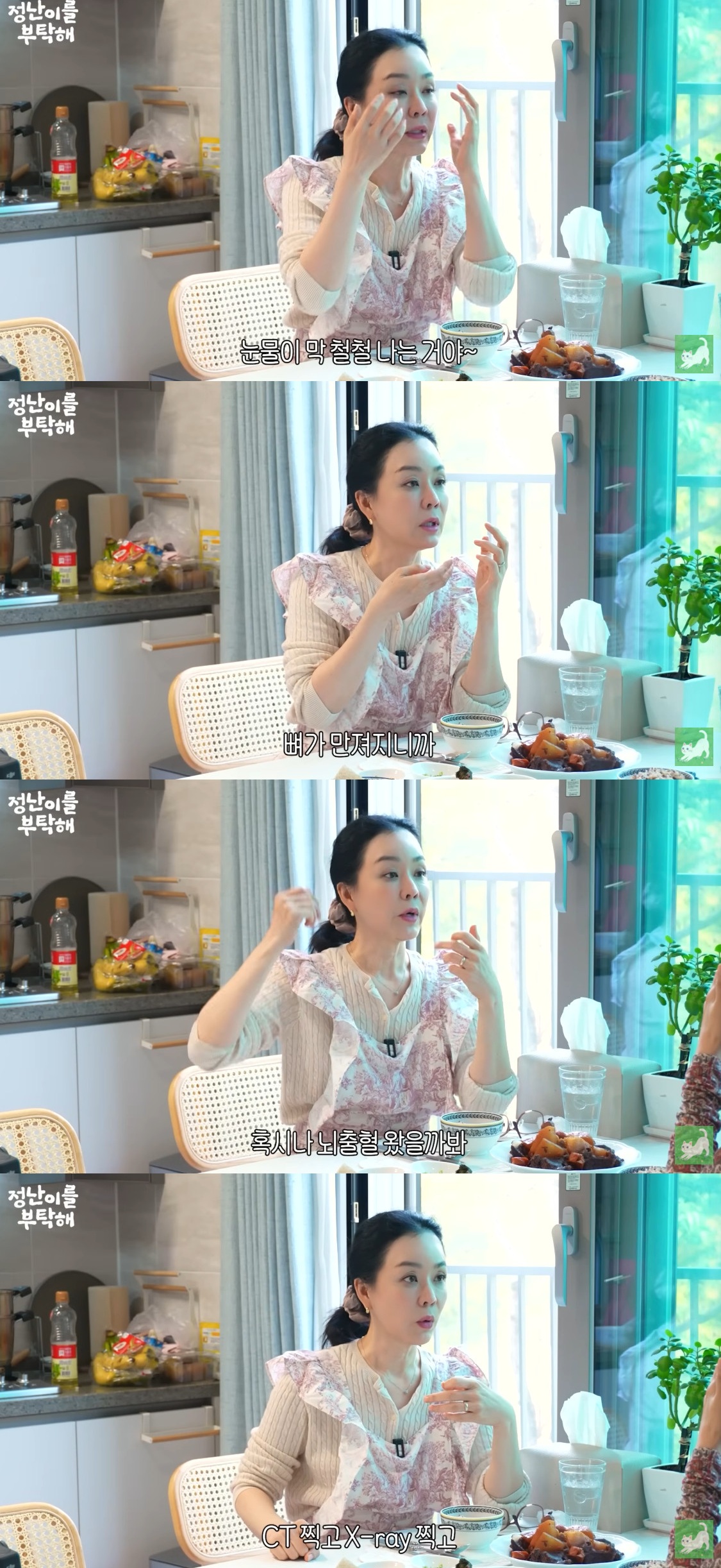 김정난이 실신 사고로 얼굴을 다쳐 턱 부상과 119 이송 당시 상황을 털어놨다.