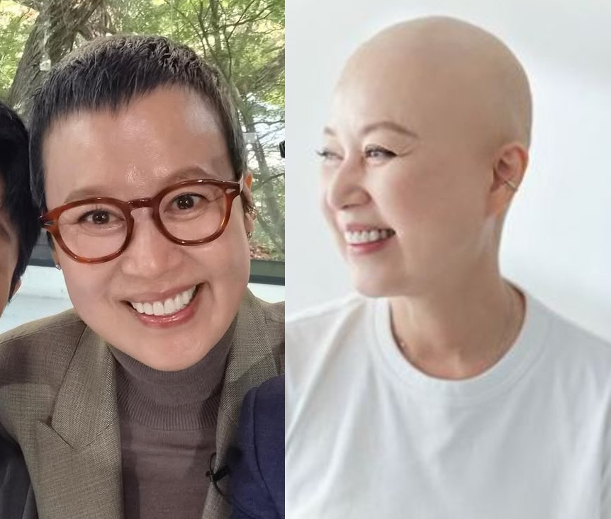 박미선이 공개한 '유퀴즈' 출연 사진 및 삭발 화보.