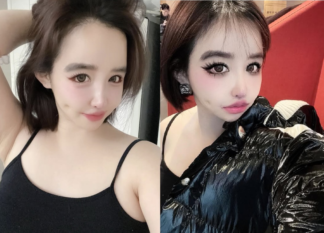 2NE1(투애니원) 멤버 박봄.