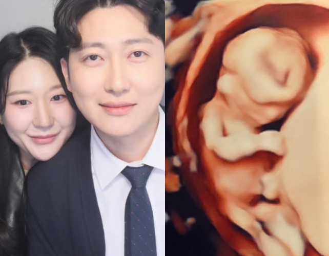 28기 정숙-상철 / 정숙 SNS.