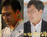 '귓볼 주름' 김수용 이어…김상욱 교수도 '심근경색' 전조 증상? "8월부터 있었다" [엑's 이슈]