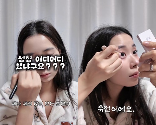 최연수가 성형수술을 하지 않았다고 밝혔다