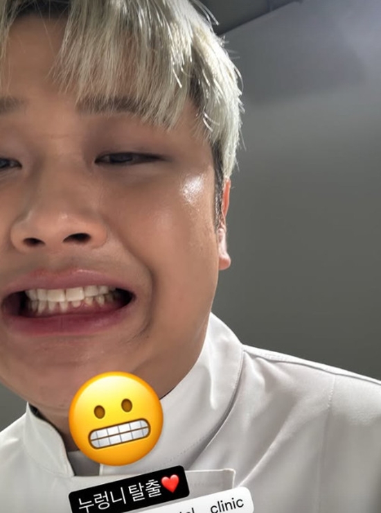 윤남노 개인 계정