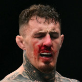 이럴 수가! 복시+안와조직 손상+경미 골절 아스피날, 2026년 통째로 날릴 수도…계속되는 의심에 충격 진단서 공개하며 반격 이제 착한 톰은 죽었다