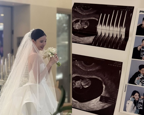 발레리라 이주리가 임신 소식을 전했다 