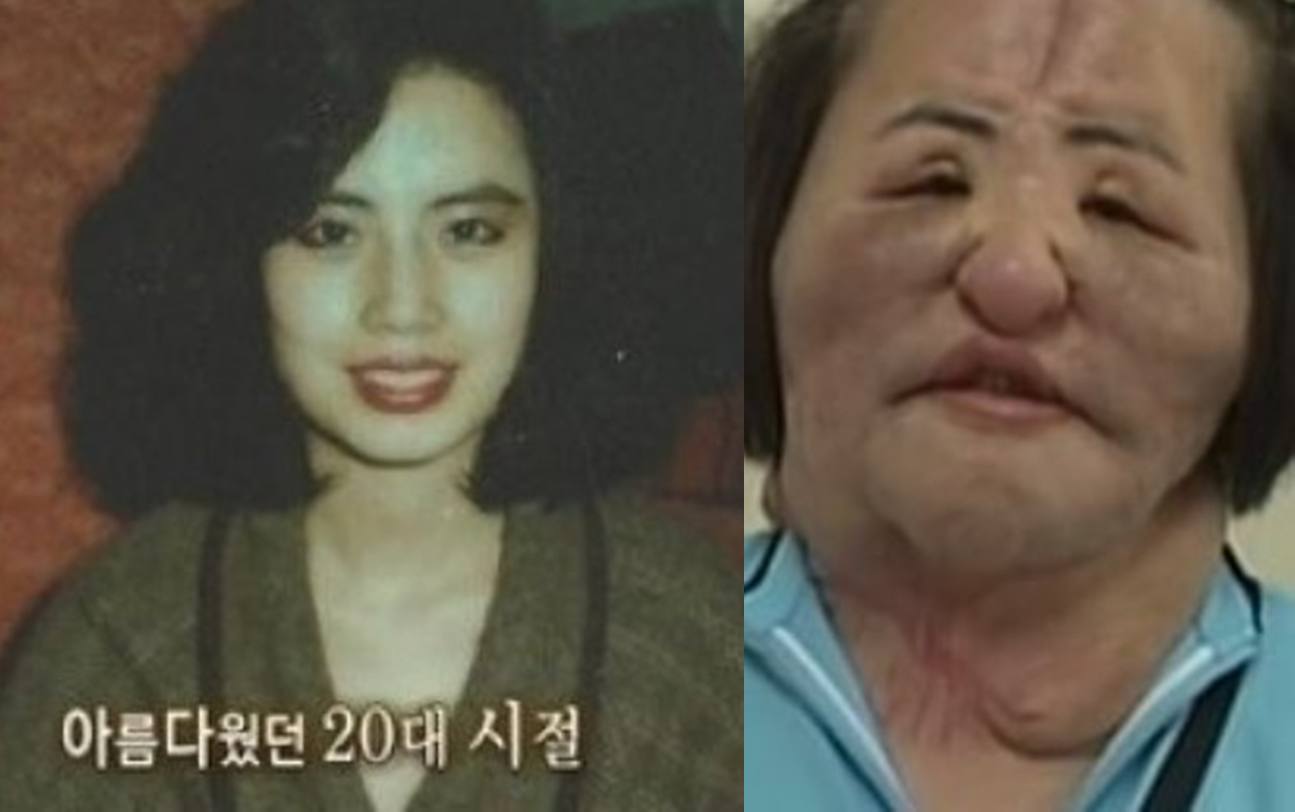 '선풍기 아줌마' 故한혜경 방송 출연분.