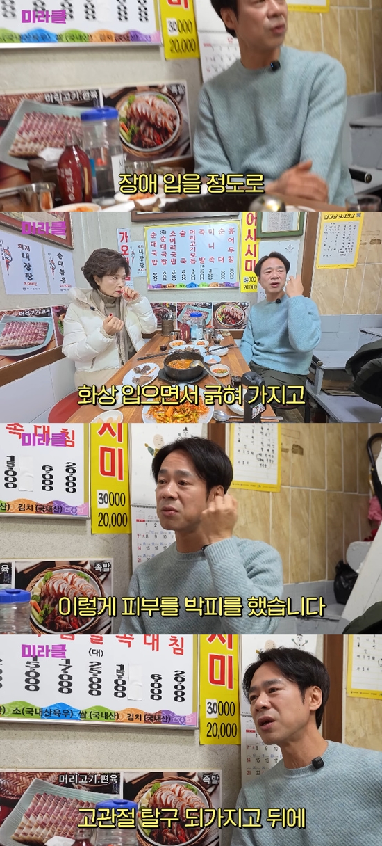 사진= 유튜브 '윤미라' 영상 캡처