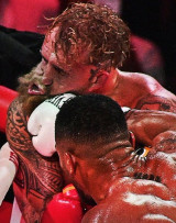 충격 주장! 턱뼈 골절 제이크 폴, 복싱 은퇴할 것!…현역 복서 PTSD 때문에 더 이상 운동 못할 거야 진단  