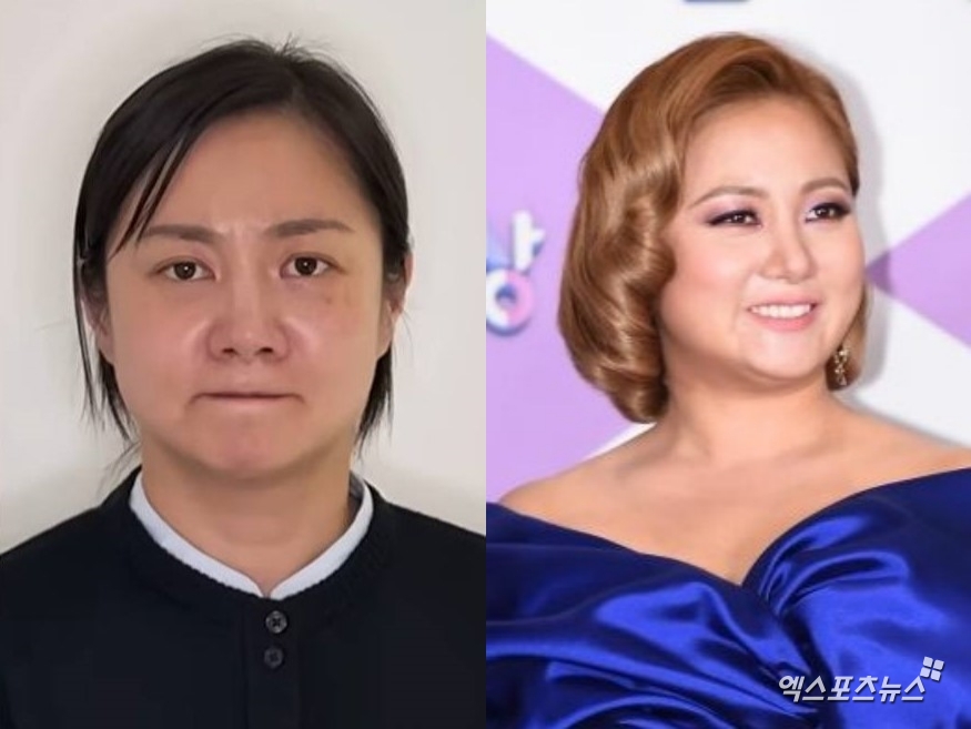 사진 = 유튜브 채널 '백은영의 골든타임', 엑스포츠뉴스 DB