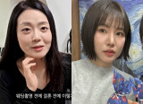 '나솔' 현숙, 몰라 볼 비포 애프터…"리프팅·보톡스" 시술 솔직 고백 [엑's 이슈]