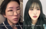 '최진실 딸' 최준희, 눈코→안면윤곽 대공사 후 튜닝…부드러워져 달라진 인상 (준희)