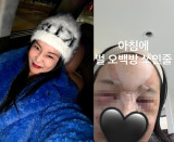 랄랄, 눈 밑 지방 재배치+코 수술 고백 후…충격 근황 벌 오백방 [★해시태그]