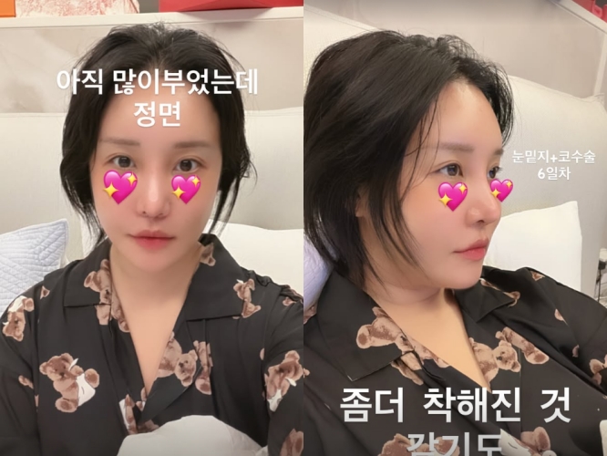 사진 = 랄랄 인스타그램 스토리