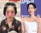 랄랄→이지혜, 성형도 콘텐츠 시대…퉁퉁 부운 얼굴도 '화제성 甲' [엑's 이슈]