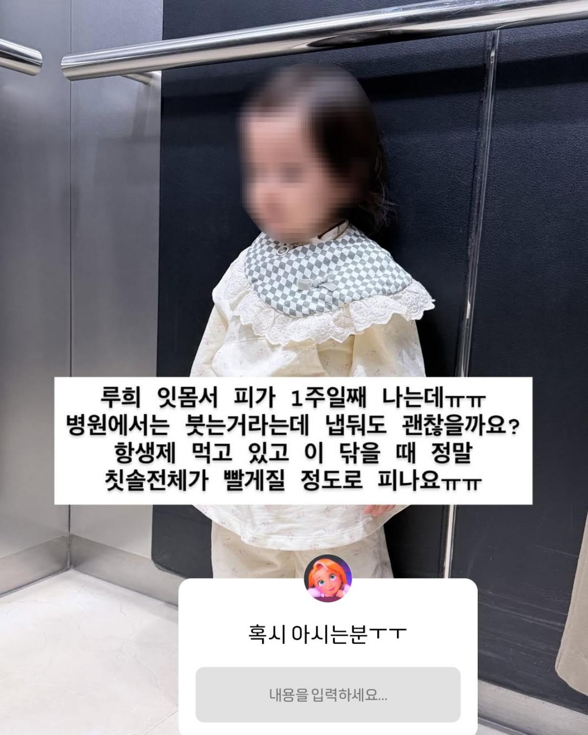 사진 = 아야네 인스타그램 스토리