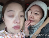 '각막 손상+응급실' 황보라, 시험관 부작용 "만신창이"…가족들이 포기 권유까지 (보라이어티)[종합]