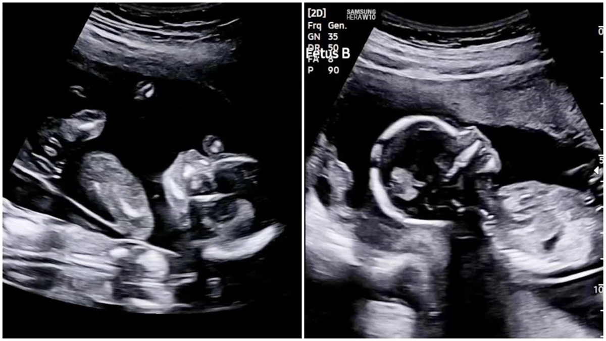 사진= 도광록 SNS