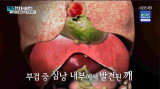 故 신해철, 심낭 내부서 먹는 '깨' 발견됐다...장도연 그게 왜 거기있냐 충격 (셀럽병사의 비밀) 