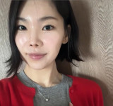 이다은, 턱 보톡스 부작용 고백…예쁘다고 해 주는 ♥윤남기 덕 버텨 [★해시태그]