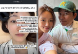 '♥임창정' 서하얀, 큰 결심했다…눈썹 문신 색소 제거 관상에 안 좋다고 [★해시태그]