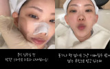'최진실 딸' 최준희, 결혼식 직전까지 피부과 스케줄 막판 스퍼트 [★해시태그]