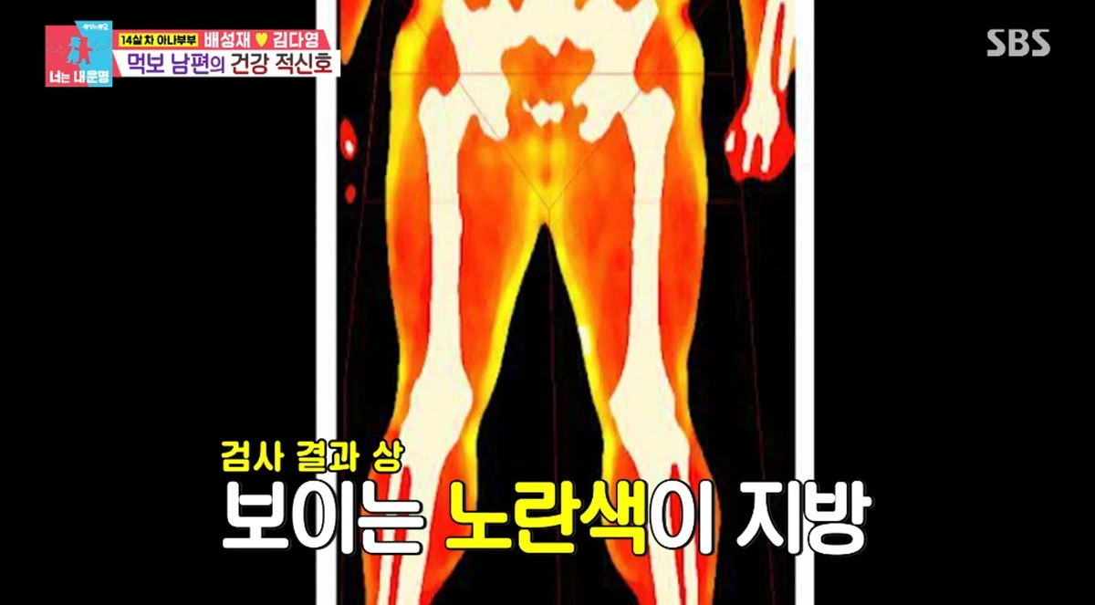 SBS '동상이몽2'