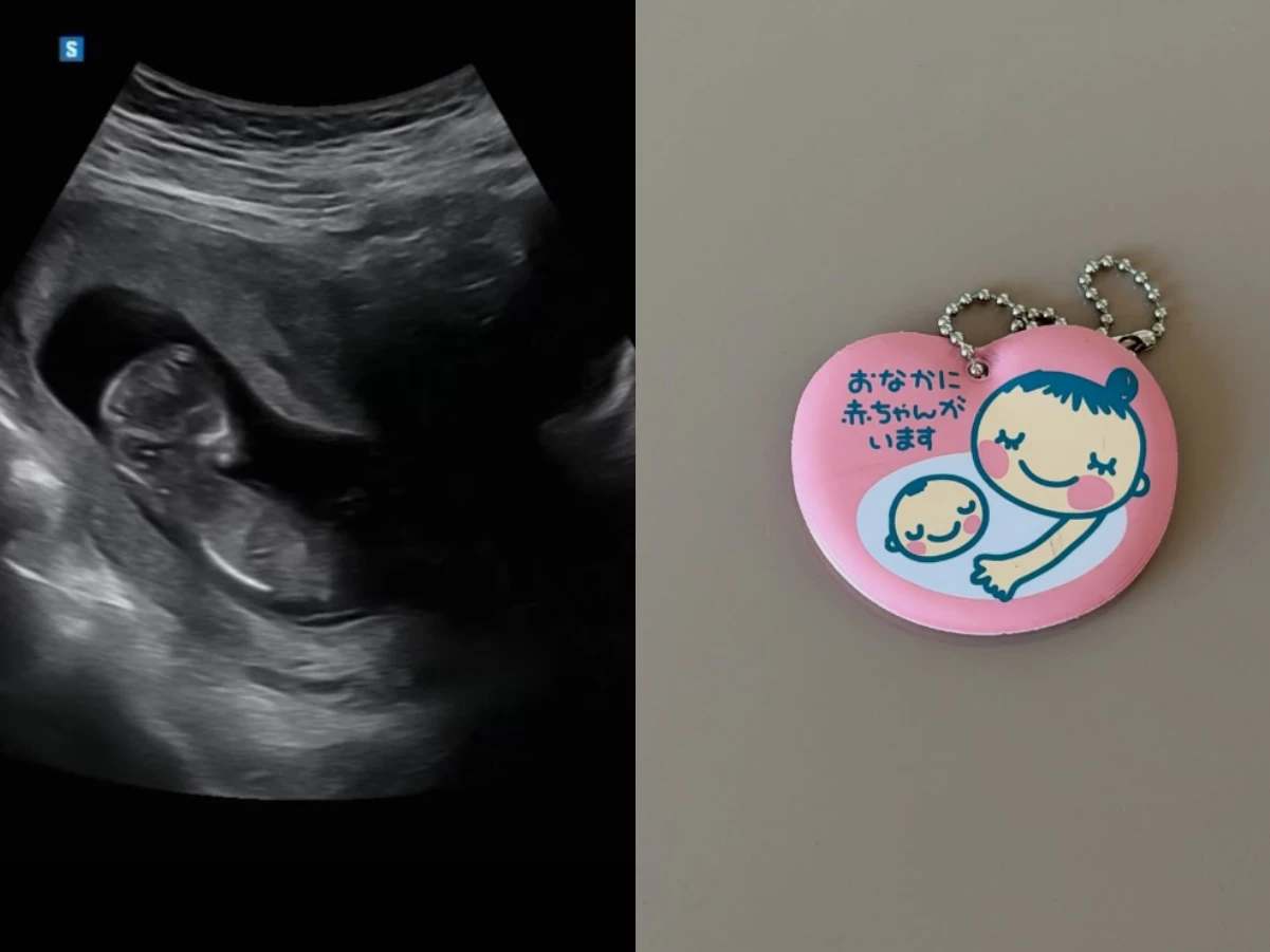 배우 구재이, 둘째 임신 발표